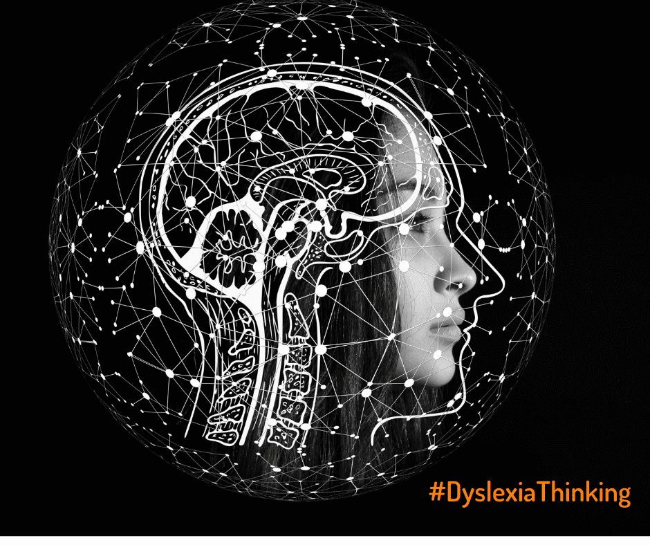 female brain image with #DyslexiaThinking tag
